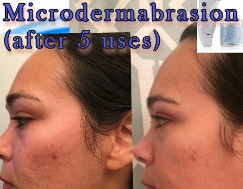 neutrogena 010417